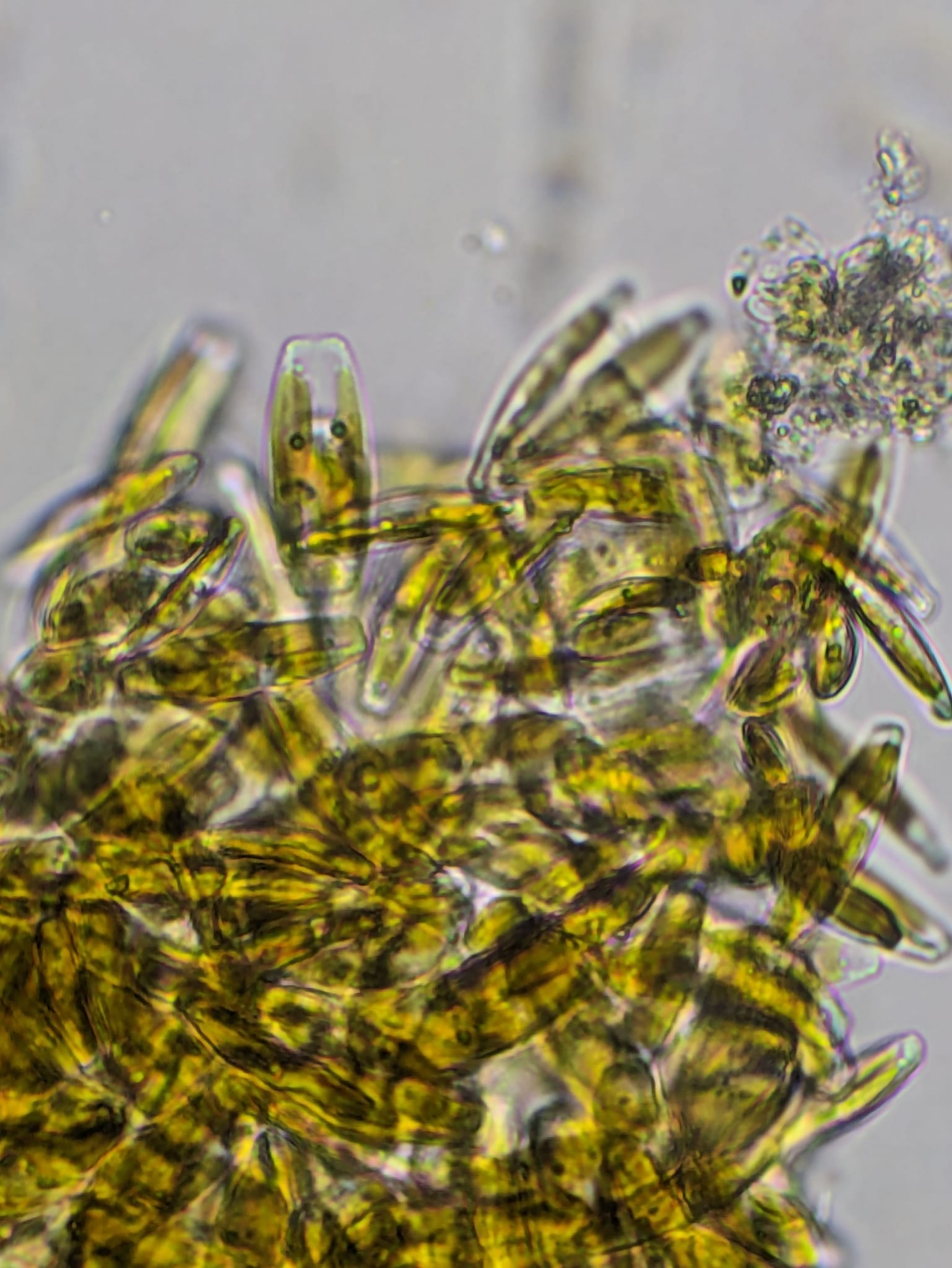 Diatom Cluster Microscope